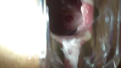 Nhìn bên trong âm hộ của cô máng mỏ vịt sex bac si
