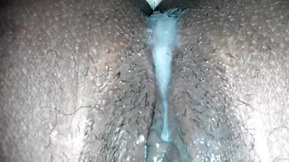 Kem chảy ra khỏi âm hộ